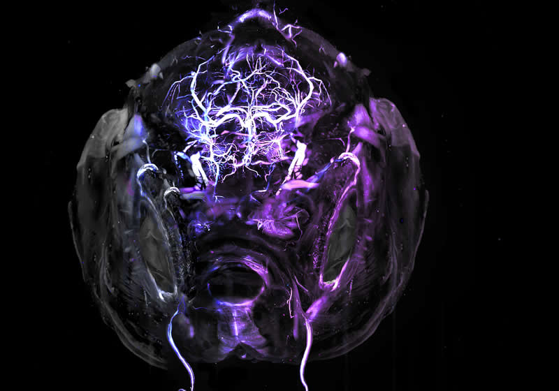 "Adult zebrafish brain" by Hannah Somers, United States - Award-Winning Microscope Photos of 2026