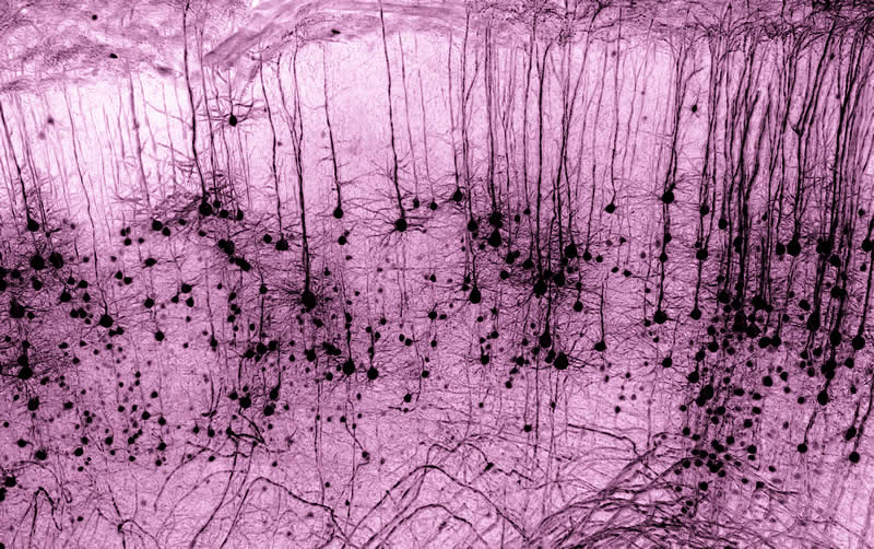 "GFP-positive Thy1 neuron in a tissue-cleared mouse brain" by Marko Pende, Austria - Award-Winning Microscope Photos of 2026