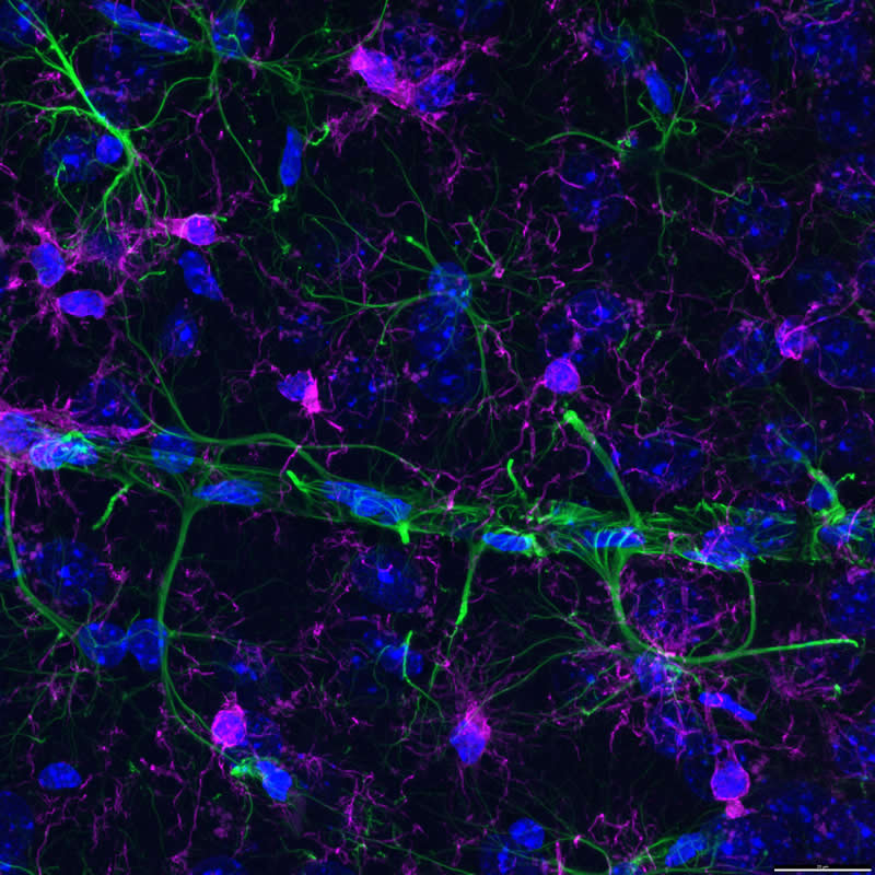 "Fluorescent immunostained brain tissue from an Alzheimer’s disease mouse model" by Bettina Rákóczi, Hungary - Award-Winning Microscope Photos of 2026