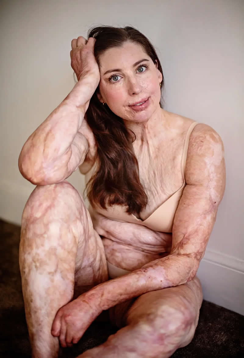 Capturing Resilience: 25 Winning Portraits From AAP Magazine's 2026 Awards 33 The Outside of the Inside by MarMartina Holmberg, Sweden - AAP Magazine 2026 Portrait Awards Winners