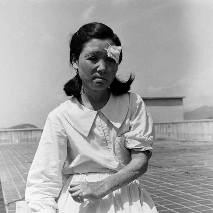 History Uncovered: 40 Powerful Photos That Change How We See the Past 47 A survivor of the atomic bombing of Hiroshima photographed two years after the attack, Hiroshima, Japan, 1947.